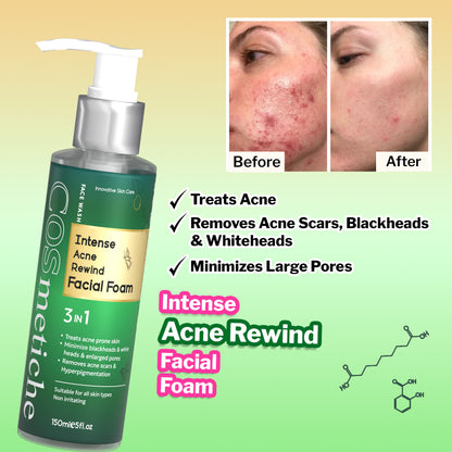 Intense Acne Rewind Facial Foam