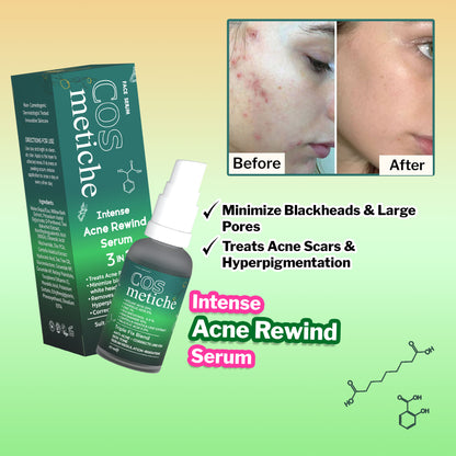 Intense Acne Rewind Serum